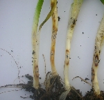 Kök Boğaz Çürüklüğü Nelerdir?