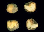 Patates Mildiyösü Hastalığı Belirtileri, Nedenleri Ve Mücadelesi