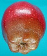 Depolama Hastalıkları: Fungal, Bakteriyel Ve Viral Etkenlerin Ürünlere