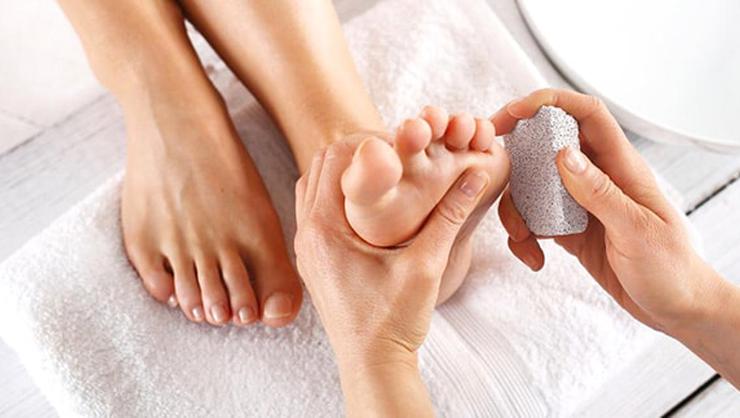 Ayakta Oluşan Nasırlar İçin Pratik Çözüm