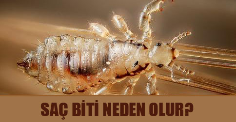 Bit Salgının Önüne Geçmek İçin Dikkat Edilmesi Gerekenler