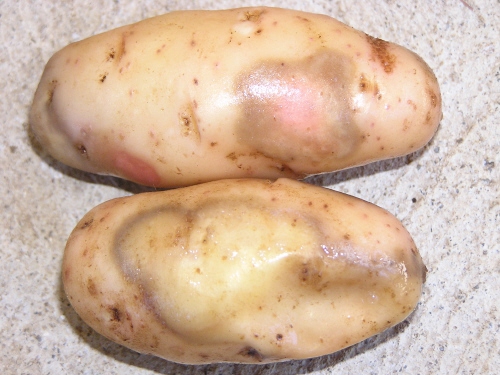 Karabacak Hastalığı