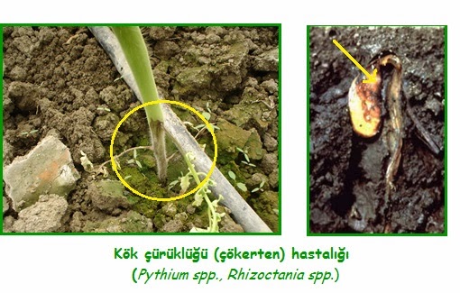 Çökerten Hastalığı