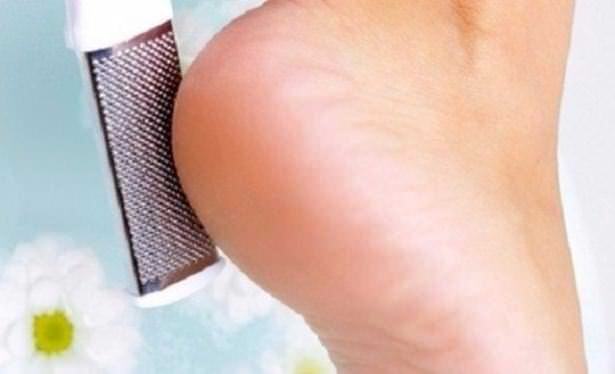 Topuklarınız Sertleşiyorsa Mutlaka Yapın!