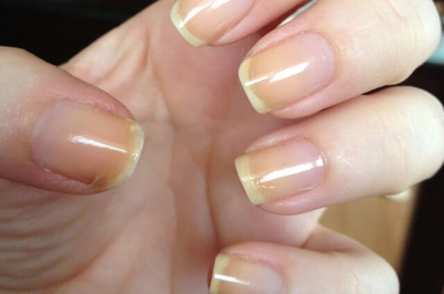 Sigaradan Sararan Tırnaklar İçin