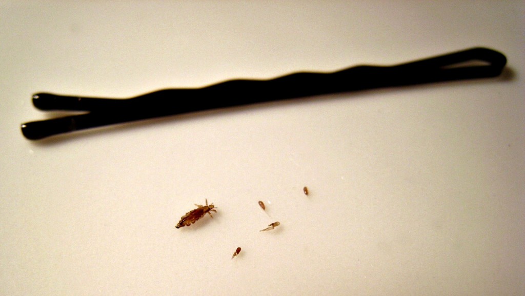 Bit Nedir, Nasıl Bulunur? Saç biti