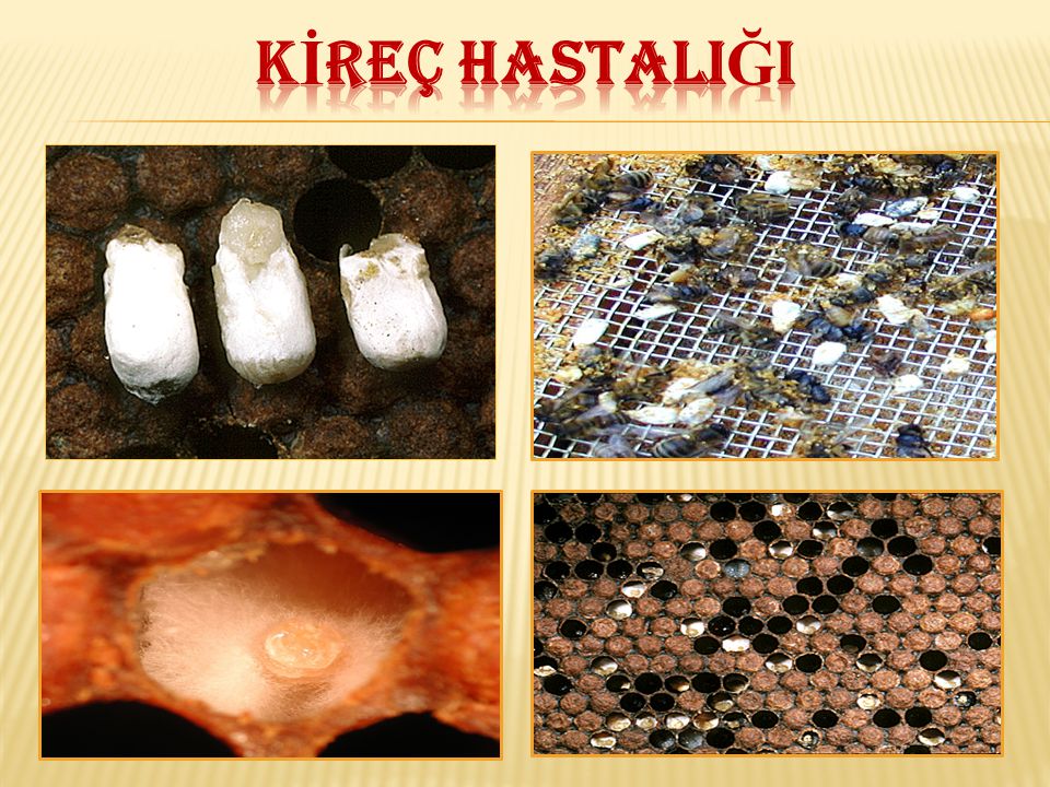 Kireç Hastalığı